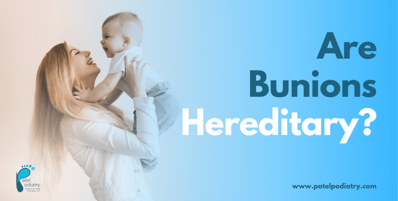 Are Bunions Hereditary? Family Foot Care & Surgery, LLC